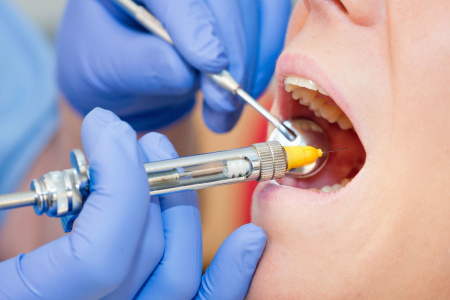 Современные виды и методы обезболивания в стоматологии.